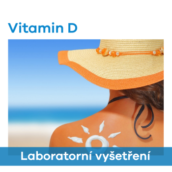 EUC Laboratoře - Vitamin D