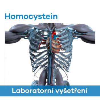 EUC Laboratoře - Homocystein